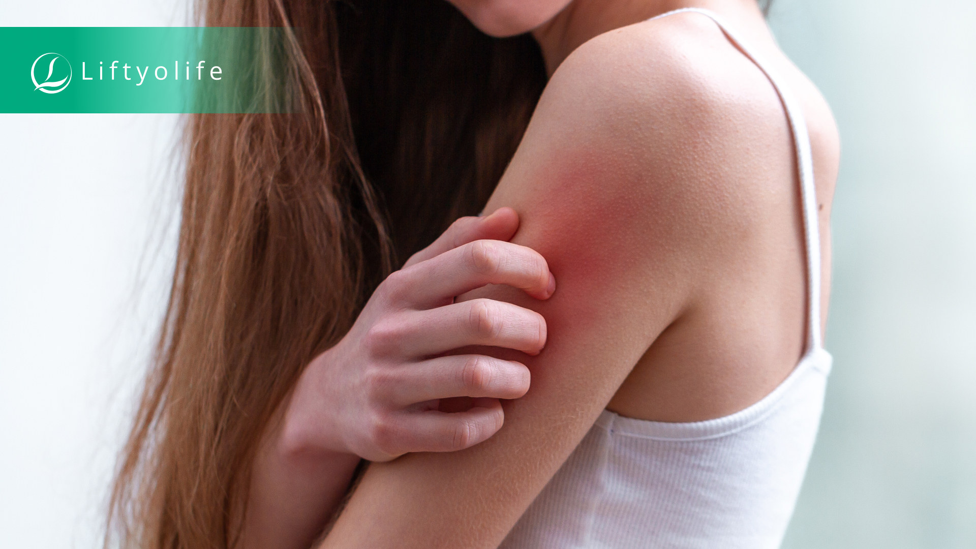 What is dermatitis?